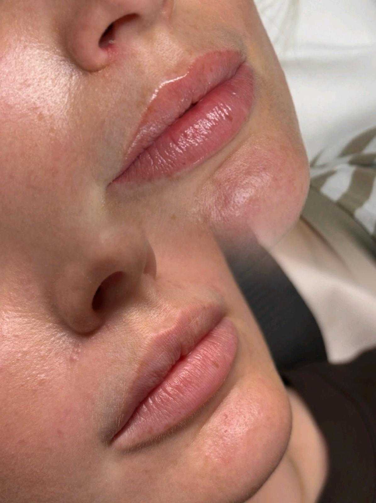 Semi-permanent makeup — natural lip blush — Healed result following a natural lip blush.
